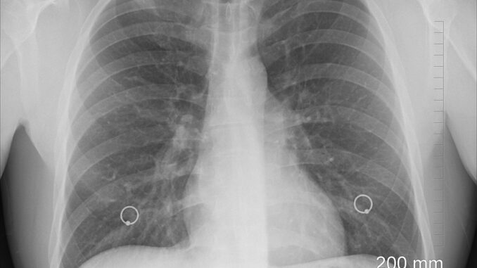 diagnosis-1476620_960_720