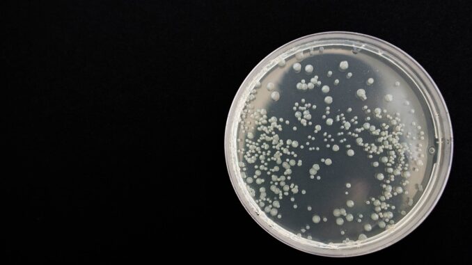 Investigación Infección